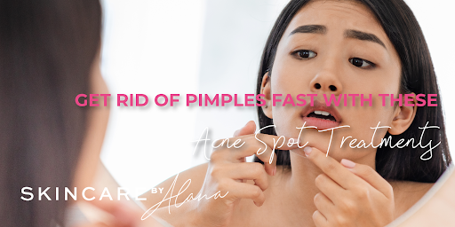 5 In a single day DIY Pimples Spot Therapies and Merchandise 5 In a single day DIY Pimples Spot Therapies and Merchandise