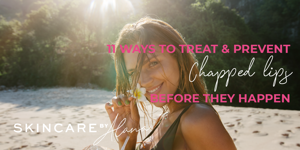 Chapped Lips Therapies | Prevention and Dwelling Treatments Chapped Lips Therapies | Prevention and Dwelling Treatments